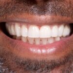 Blizak prikaz osmeha odraslog muškarca sa zdravim zubima i desnima.